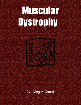 Muscular Dystrophy