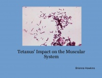 Tetanus' Impact on the Muscular System