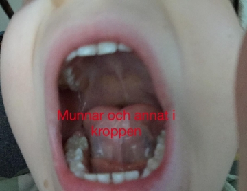 *